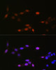 Immunofluorescence analysis of NIH-3T3 cells using MonoMethyl-Histone H3-K14 Polyclonal Antibody at dilution of  1:100 (40x lens). Blue: DAPI for nuclear staining.