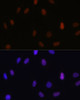 Immunofluorescence analysis of U-2 OS cells using MonoMethyl-Histone H3-K14 Polyclonal Antibody at dilution of  1:100 (40x lens). Blue: DAPI for nuclear staining.