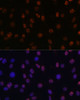 Immunofluorescence analysis of C6 cells using DiMethyl-Histone H3-K14 Polyclonal Antibody at dilution of  1:100 (40x lens). Blue: DAPI for nuclear staining.