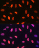 Immunofluorescence analysis of U-2 OS cells using DiMethyl-Histone H3-K14 Polyclonal Antibody at dilution of  1:100 (40x lens). Blue: DAPI for nuclear staining.