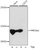 Western blot analysis of extracts of various cell lines using Acetyl-Histone H4-K16 Polyclonal Antibody at dilution of 1:1000.