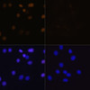 Immunofluorescence analysis of C6 cells using Acetyl-Histone H4-K16 Polyclonal Antibody at dilution of  1:100. Blue: DAPI for nuclear staining.C6 cells were treated by TSA (1 uM) at 37℃ for 18 hours. Blue: DAPI for nuclear staining.