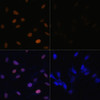Immunofluorescence analysis of NIH/3T3 cells using Acetyl-Histone H4-K16 Polyclonal Antibody at dilution of  1:100. Blue: DAPI for nuclear staining.NIH/3T3 cells were treated by TSA (1 uM) at 37℃ for 18 hours. Blue: DAPI for nuclear staining.