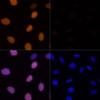 Immunofluorescence analysis of U-2 OS cells using Acetyl-Histone H4-K16 Polyclonal Antibody at dilution of  1:100. Blue: DAPI for nuclear staining.U2OS cells were treated by TSA (1 uM) at 37℃ for 18 hours. Blue: DAPI for nuclear staining.