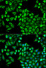 Immunofluorescence analysis of A549 cells using ABAT Polyclonal Antibody