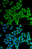 Immunofluorescence analysis of MCF-7 cells using DAO Polyclonal Antibody