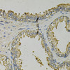 Immunohistochemistry of paraffin-embedded Human prostate using FABP1 Polyclonal Antibody at dilution of  1:100 (40x lens).