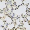 Immunohistochemistry of paraffin-embedded Rat lung using GTF2H2 Polyclonal Antibody at dilution of  1:100 (40x lens).