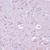Immunohistochemistry of paraffin-embedded Rat brain using PRKACB Polyclonal Antibody at dilution of  1:100 (40x lens).