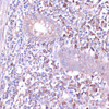 Immunohistochemistry of paraffin-embedded Human appendix using PRKACB Polyclonal Antibody at dilution of  1:100 (40x lens).