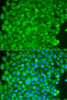 Immunofluorescence analysis of HeLa cells using SGCE Polyclonal Antibody