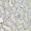 Immunohistochemistry of paraffin-embedded Mouse kidney using SLC4A4 / NBC Polyclonal Antibody at dilution of  1:100 (40x lens).