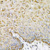 Immunohistochemistry of paraffin-embedded Human esophagus using EFNA1 Polyclonal Antibody at dilution of  1:100 (40x lens).