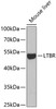 Western blot analysis of extracts of Mouse liver using LTBR Polyclonal Antibody at dilution of 1:1000.