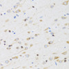 Immunohistochemistry of paraffin-embedded Rat brain using CHRM5 Polyclonal Antibody at dilution of  1:100 (40x lens).