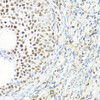 Immunohistochemistry of paraffin-embedded Rat ovary using BACH1 Polyclonal Antibody at dilution of  1:100 (40x lens).