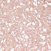 Immunohistochemistry of paraffin-embedded Rat brain using STXBP1 Polyclonal Antibody at dilution of  1:100 (40x lens).