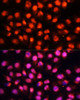 Immunofluorescence analysis of HeLa cells using STXBP1 Polyclonal Antibody at dilution of  1:100 (40x lens). Blue: DAPI for nuclear staining.