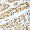 Immunohistochemistry of paraffin-embedded Human stomach using RPS6KA3 Polyclonal Antibody at dilution of  1:100 (40x lens).