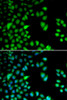 Immunofluorescence analysis of HeLa cells using RPS6KA3 Polyclonal Antibody
