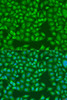 Immunofluorescence analysis of U2OS cells using MERTK Polyclonal Antibody at dilution of  1:100. Blue: DAPI for nuclear staining.