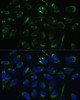 Immunofluorescence analysis of U-2 OS cells using HSD17B10 Polyclonal Antibody at dilution of  1:100 (40x lens). Blue: DAPI for nuclear staining.