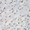 Immunohistochemistry of paraffin-embedded Mouse brain using PSMB10 Polyclonal Antibody at dilution of  1:200 (40x lens).