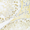 Immunohistochemistry of paraffin-embedded Rat testis using RFC4 Polyclonal Antibody at dilution of  1:100 (40x lens).