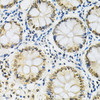 Immunohistochemistry of paraffin-embedded Human colon using SNRPE Polyclonal Antibody at dilution of  1:200 (40x lens).