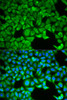 Immunofluorescence analysis of HeLa cells using SLC3A1 Polyclonal Antibody