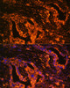 Immunofluorescence analysis of Human lung cancer cells using SCNN1A Polyclonal Antibody at dilution of  1:100. Blue: DAPI for nuclear staining.