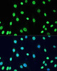 Immunofluorescence analysis of C6 cells using Acetyl-DNMT1-K1127/K1129/K1131/K1133 Polyclonal Antibody at dilution of  1:100. Blue: DAPI for nuclear staining.