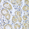 Immunohistochemistry of paraffin-embedded Human stomach using FBXL5 Polyclonal Antibody at dilution of  1:100 (40x lens).