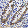 Immunohistochemistry of paraffin-embedded Human vermiform appendix using PGRMC1 Polyclonal Antibody at dilution of  1:100 (40x lens).