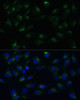 Immunofluorescence analysis of C6 cells using PGRMC1 Polyclonal Antibody at dilution of  1:100 (40x lens). Blue: DAPI for nuclear staining.