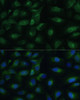 Immunofluorescence analysis of U-2 OS cells using PGRMC1 Polyclonal Antibody at dilution of  1:100 (40x lens). Blue: DAPI for nuclear staining.