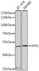 Western blot analysis of extracts of various cell lines using TPP1 Polyclonal Antibody at dilution of 1:1000.