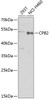 Western blot analysis of extracts of various cell lines using CPB2 Polyclonal Antibody at dilution of 1:1000.