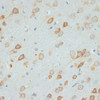 Immunohistochemistry of paraffin-embedded Rat brain using DDX3X Polyclonal Antibody at dilution of  1:100 (40x lens).