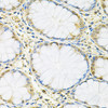 Immunohistochemistry of paraffin-embedded Human colon using FMR1 Polyclonal Antibody at dilution of  1:100 (40x lens).