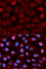 Immunofluorescence analysis of U2OS cells using FMR1 Polyclonal Antibody