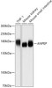 Western blot analysis of extracts of various cell lines using ANPEP Polyclonal Antibody at dilution of 1:1000.