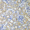 Immunohistochemistry of paraffin-embedded Rat kidney using KITLG Polyclonal Antibody at dilution of  1:200 (40x lens).