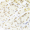 Immunohistochemistry of paraffin-embedded Human stomach using RBPJ Polyclonal Antibody at dilution of  1:100 (40x lens).