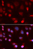Immunofluorescence analysis of U2OS cells using ATP7B Polyclonal Antibody