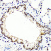 Immunohistochemistry of paraffin-embedded Rat lung using TET2 Polyclonal Antibody at dilution of  1:100 (40x lens).