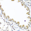 Immunohistochemistry of paraffin-embedded Mouse lung using TET2 Polyclonal Antibody at dilution of  1:100 (40x lens).