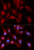 Immunofluorescence analysis of U2OS cells using PSMB4 Polyclonal Antibody