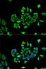 Immunofluorescence analysis of U2OS cells using CLCN5 Polyclonal Antibody