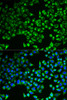 Immunofluorescence analysis of MCF-7 cells using CS Polyclonal Antibody
